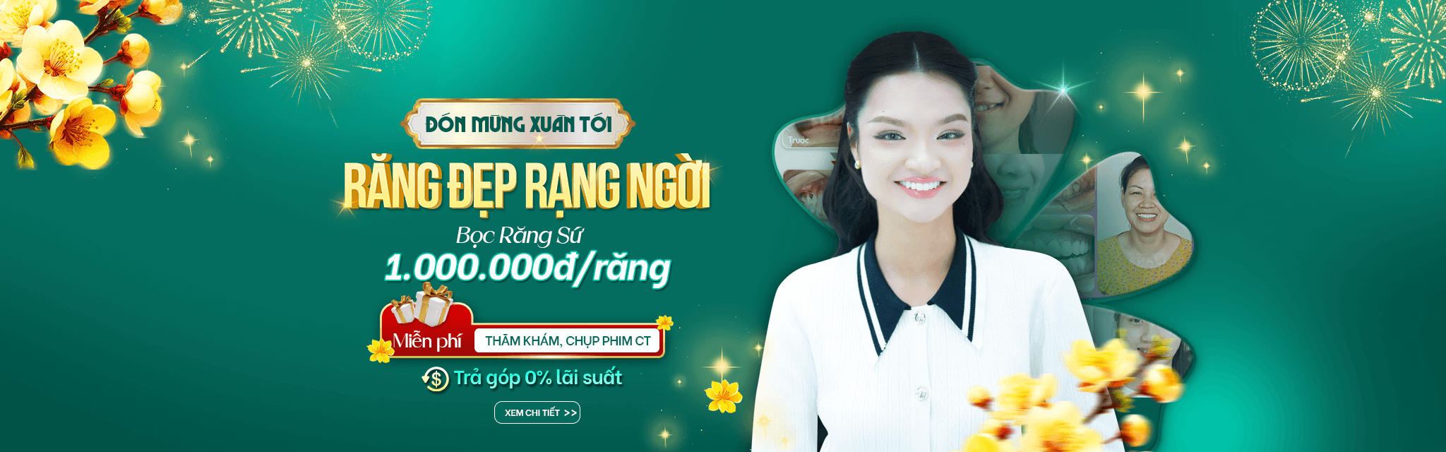 Ưu Đãi Bọc Răng Sứ